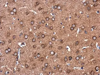 Anti-COLEC12 antibody [N2C1], Internal used in IHC (Paraffin sections) (IHC-P). GTX116892