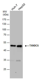 Anti-TXNDC5 antibody used in Western Blot (WB). GTX116898