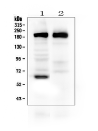 Anti-Thrombospondin 2 antibody used in Western Blot (WB). GTX11699