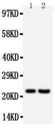 Anti-FGF9 antibody used in Western Blot (WB). GTX11703