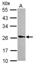 Anti-Phospholipase A2 XIIA antibody [N1C3] used in Western Blot (WB). GTX117089