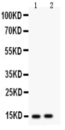 Anti-FABP5 antibody used in Western Blot (WB). GTX11725