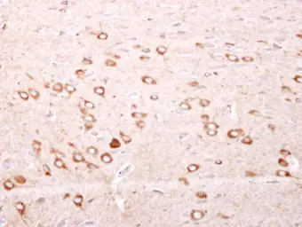 Anti-Mitochondrial Ferritin antibody [N1C3] used in IHC (Paraffin sections) (IHC-P). GTX117281