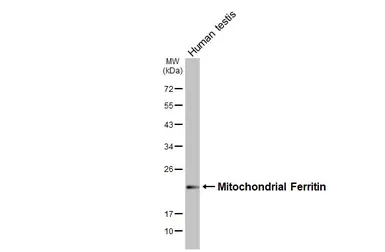 Anti-Mitochondrial Ferritin antibody [N1C3] used in Western Blot (WB). GTX117281
