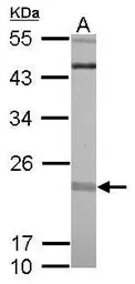 Anti-RIT1 antibody used in Western Blot (WB). GTX117329