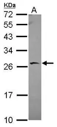 Anti-BAG2 antibody [N1C3-2] used in Western Blot (WB). GTX117345