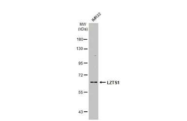 Anti-LZTS1 antibody [C1C3] used in Western Blot (WB). GTX117376