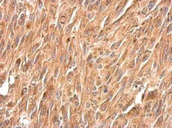 Anti-Periplakin antibody [N1N2], N-term used in IHC (Paraffin sections) (IHC-P). GTX117411