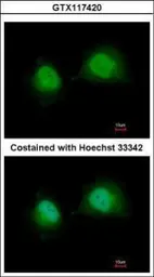 Anti-GTF2A1 antibody used in Immunocytochemistry/ Immunofluorescence (ICC/IF). GTX117420