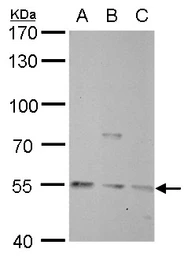 Anti-Visfatin antibody [N1N3] used in Western Blot (WB). GTX117444