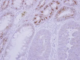 Anti-GCKR antibody used in IHC (Paraffin sections) (IHC-P). GTX117492