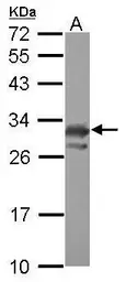 Anti-PCMT1 antibody used in Western Blot (WB). GTX117559