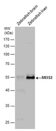 Anti-MEIS2 antibody used in Western Blot (WB). GTX117564