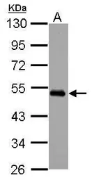 Anti-MEIS2 antibody used in Western Blot (WB). GTX117564