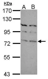 Anti-TBR1 antibody [N2C1], Internal used in Western Blot (WB). GTX117615