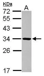 Anti-RRP4 antibody [N1C3] used in Western Blot (WB). GTX117616