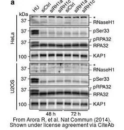 Anti-RNase H1 antibody [N2C3] used in Western Blot (WB). GTX117624