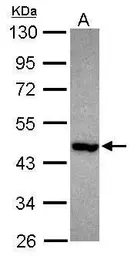Anti-PNMA2 antibody used in Western Blot (WB). GTX117650
