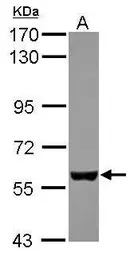 Anti-EBF3 antibody [C1C3] used in Western Blot (WB). GTX117656
