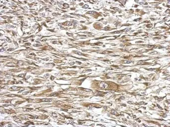 Anti-MMS2 antibody used in IHC (Paraffin sections) (IHC-P). GTX117707