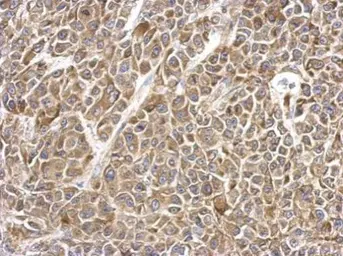 Anti-MMS2 antibody used in IHC (Paraffin sections) (IHC-P). GTX117707