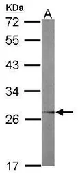 Anti-UBC3B antibody used in Western Blot (WB). GTX117722