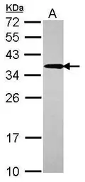 Anti-UBC3B antibody used in Western Blot (WB). GTX117722