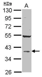 Anti-AKR1D1 antibody [N3C3] used in Western Blot (WB). GTX117738