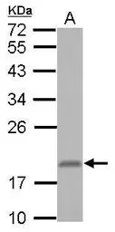 Anti-RNF181 antibody used in Western Blot (WB). GTX117747