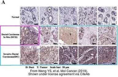 Anti-MCTS1 antibody [N1C3] used in Immunohistochemistry (IHC). GTX117793