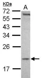 Anti-MCTS1 antibody [N1C3] used in Western Blot (WB). GTX117793