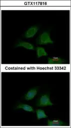 Anti-Sec8 antibody used in Immunocytochemistry/ Immunofluorescence (ICC/IF). GTX117816