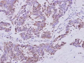 Anti-Sec8 antibody used in IHC (Paraffin sections) (IHC-P). GTX117816