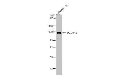 Anti-PCDH10 antibody [N1N2], N-term used in Western Blot (WB). GTX117863