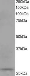 Anti-DCXR antibody, C-term used in Western Blot (WB). GTX11800