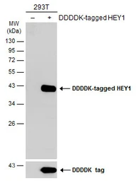 Anti-HEY1 antibody used in Western Blot (WB). GTX118007