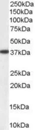 Anti-AKR1A1 antibody, C-term used in Western Blot (WB). GTX11802