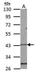 Anti-Homeobox C10 antibody used in Western Blot (WB). GTX118025