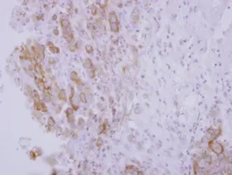 Anti-OSBPL5 antibody [N3C1], Internal used in IHC (Paraffin sections) (IHC-P). GTX118036