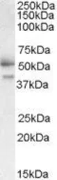 Anti-FSTL1 antibody, C-term used in Western Blot (WB). GTX11805