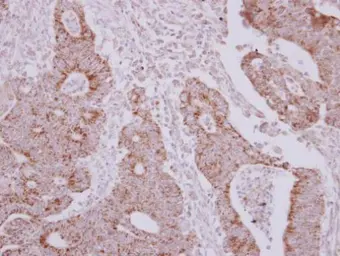 Anti-NARS2 antibody [N1C1] used in IHC (Paraffin sections) (IHC-P). GTX118096