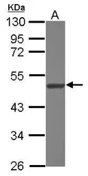 Anti-NARS2 antibody [N1C1] used in Western Blot (WB). GTX118096
