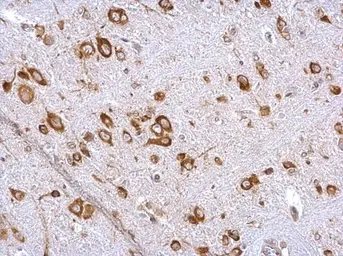 Anti-EIF4G3 antibody [N1], N-term used in IHC (Paraffin sections) (IHC-P). GTX118109
