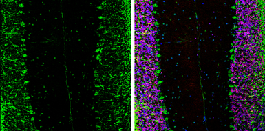 Anti-EIF4G3 antibody [N1], N-term used in IHC (Frozen sections) (IHC-Fr). GTX118109