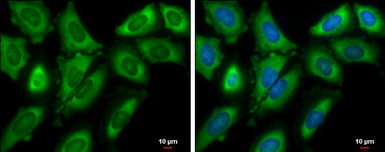 Anti-EIF4G3 antibody [N1], N-term used in Immunocytochemistry/ Immunofluorescence (ICC/IF). GTX118109