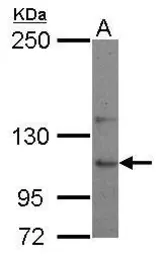 Anti-USP26 antibody [C2C3], C-term used in Western Blot (WB). GTX118119