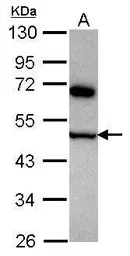 Anti-COPS4 antibody [N1C1] used in Western Blot (WB). GTX118165