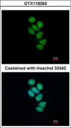 Anti-SMNDC1 antibody [N1C3-2] used in Immunocytochemistry/ Immunofluorescence (ICC/IF). GTX118263