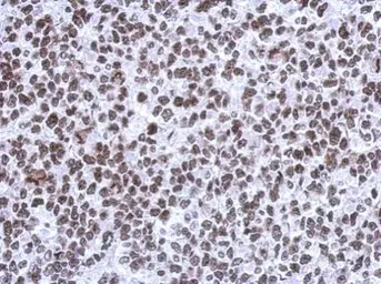 Anti-SMNDC1 antibody [N1C3-2] used in IHC (Paraffin sections) (IHC-P). GTX118263