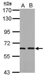 Anti-Tub antibody used in Western Blot (WB). GTX118348
